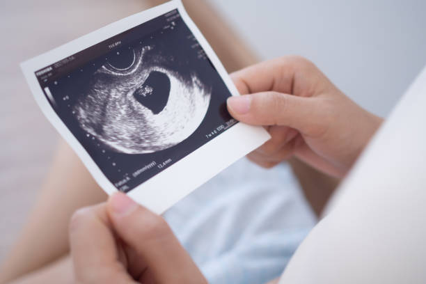 Ảnh bìa bài viết: Có Nên Đi Siêu Âm Thường Xuyên Không? Sự Thật Mẹ Bầu Cần Biết